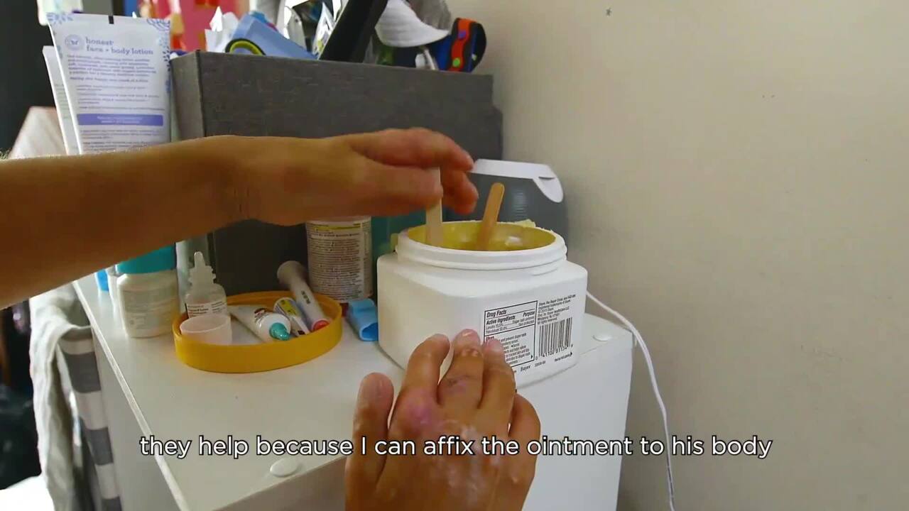 Changing your baby’s diaper