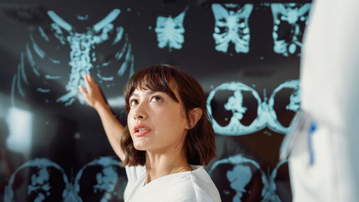 Progression of Sjögren's syndrome with ILD