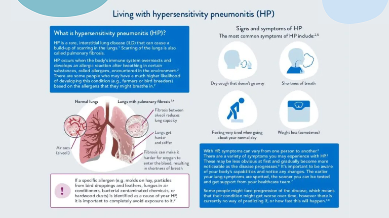 Hypersensitivity pneumonitis (HP)